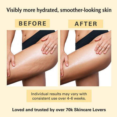Anti-Cellulite Massage Oil 240ml || Deeply Nourishing Improves